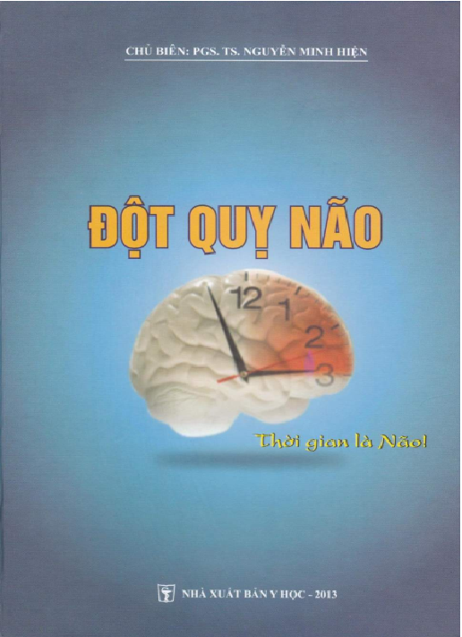 Đột quỵ não
